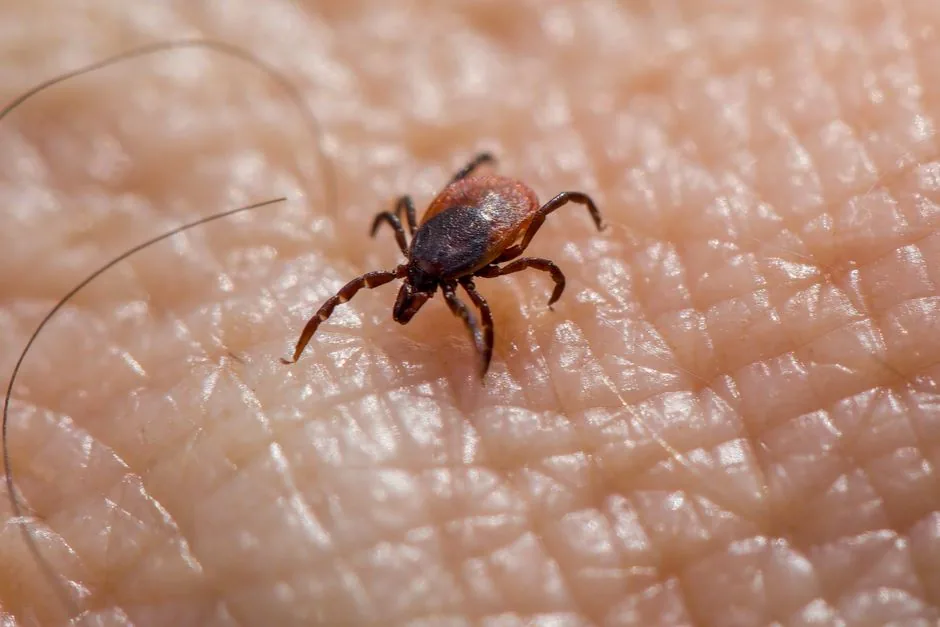 Can Anisakiasis Kill You? Rare but Serious