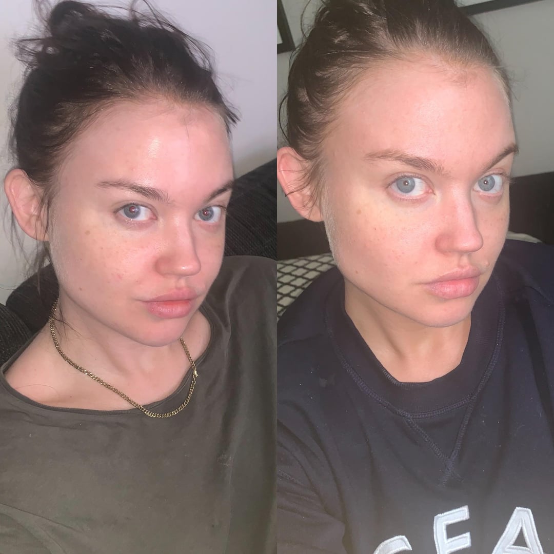 Gluten Withdrawal Reddit: Symptoms, Timeline & Tips