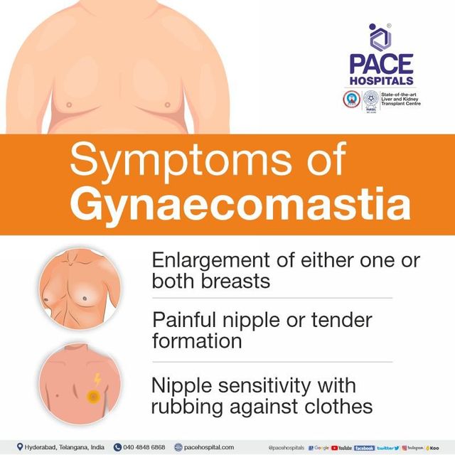 Gynecomastia Cancer Symptoms: What You Need to Know