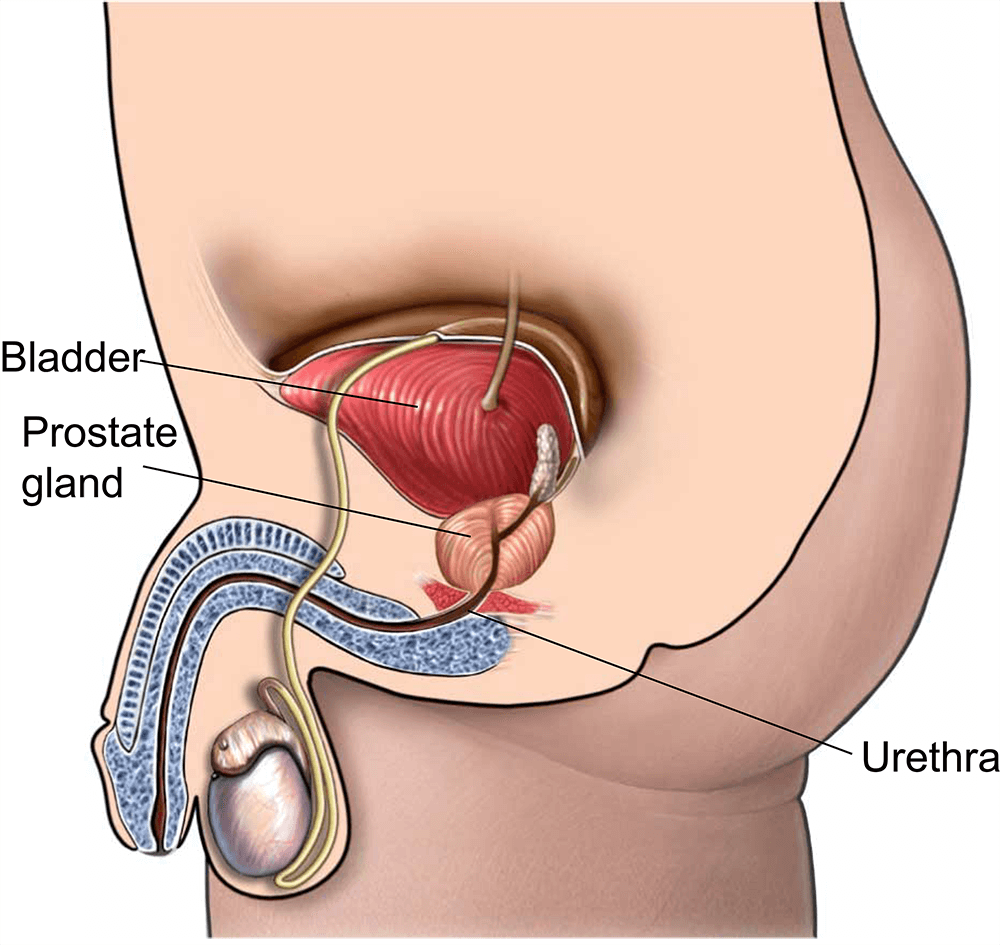 Laparoscopic Radical Prostatectomy: Fast Recovery
