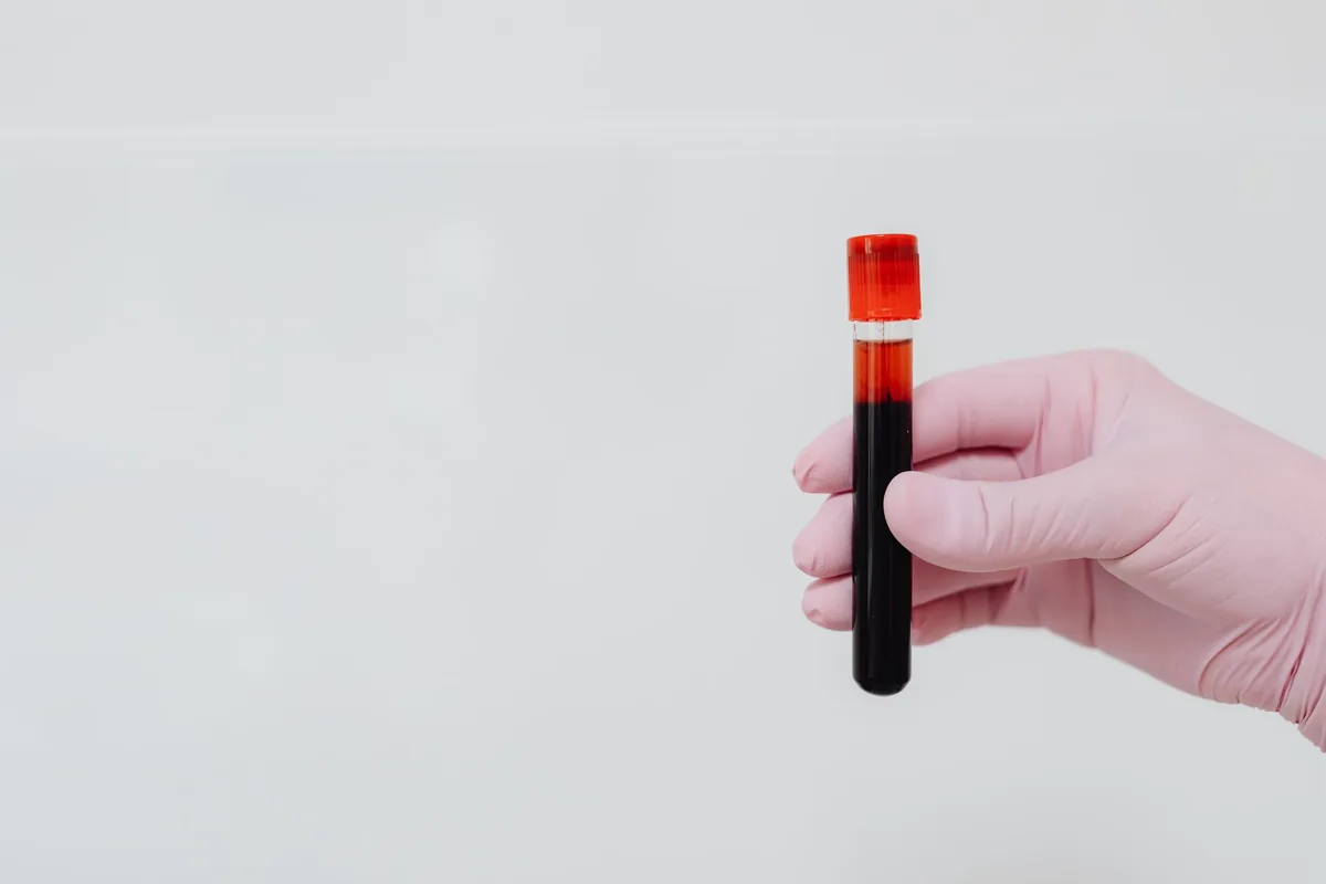 Rh Null Blood Type Explained: Is Golden Blood a Gift or a Transfusion Risk?
