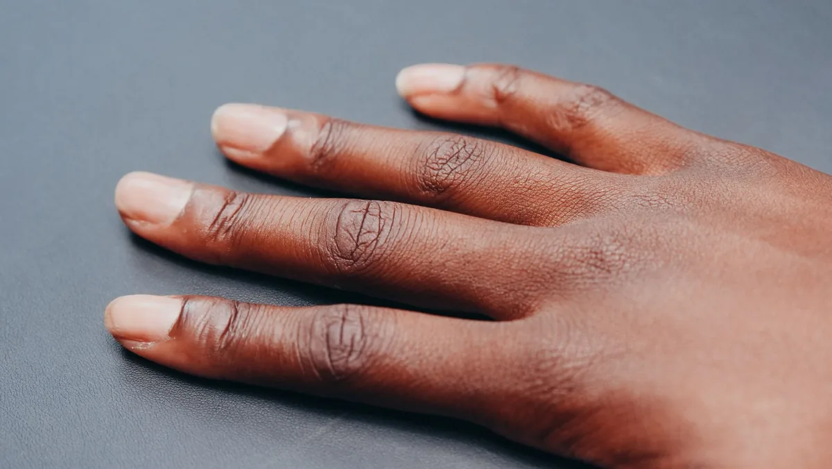 Why Hands Always Feel Cold: Causes, Symptoms, and Red Flags