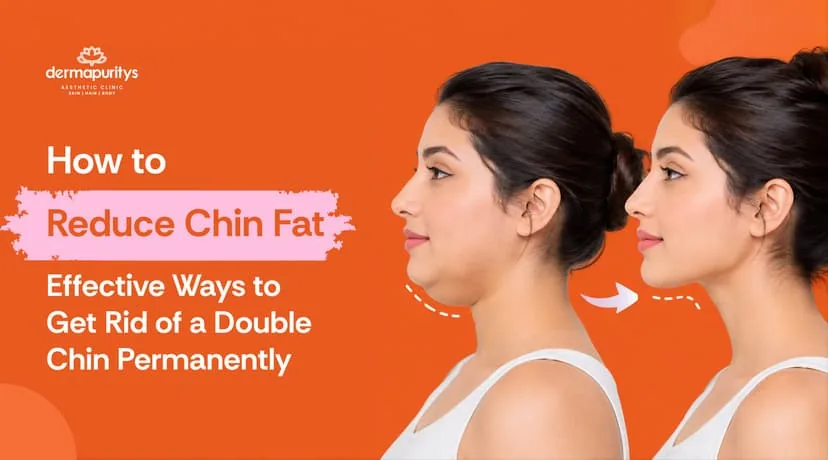 What Are the Most Effective Natural Ways to Reduce Double Chin Fat?